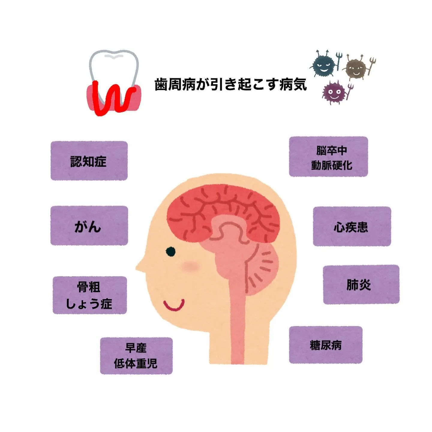 疾病リスクを引き上げる“口腔内細菌”👾