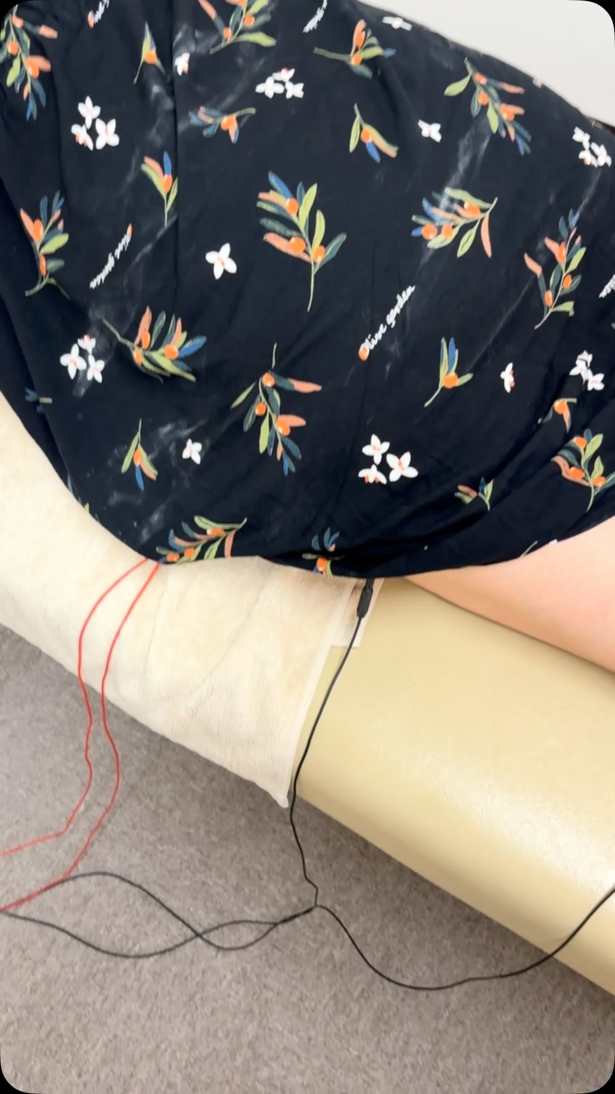 本日、治療に来られた50代の女性です。