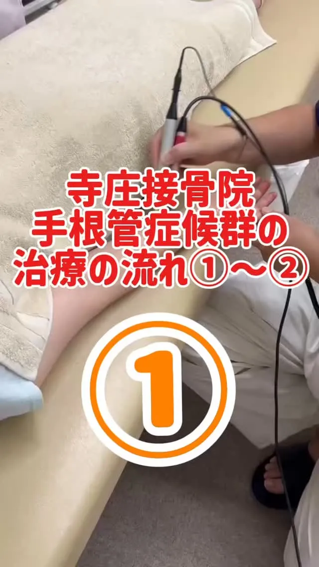 【手根管症候群の治療① アキュスコーププローブ通電】